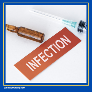 Cara Kerja Sunat Laser